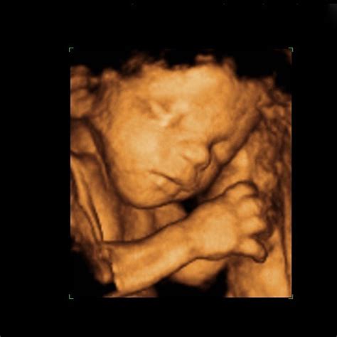 3d baby scan alvechurch  Facebook Page Link Twitter Page Link Instagram Page Link